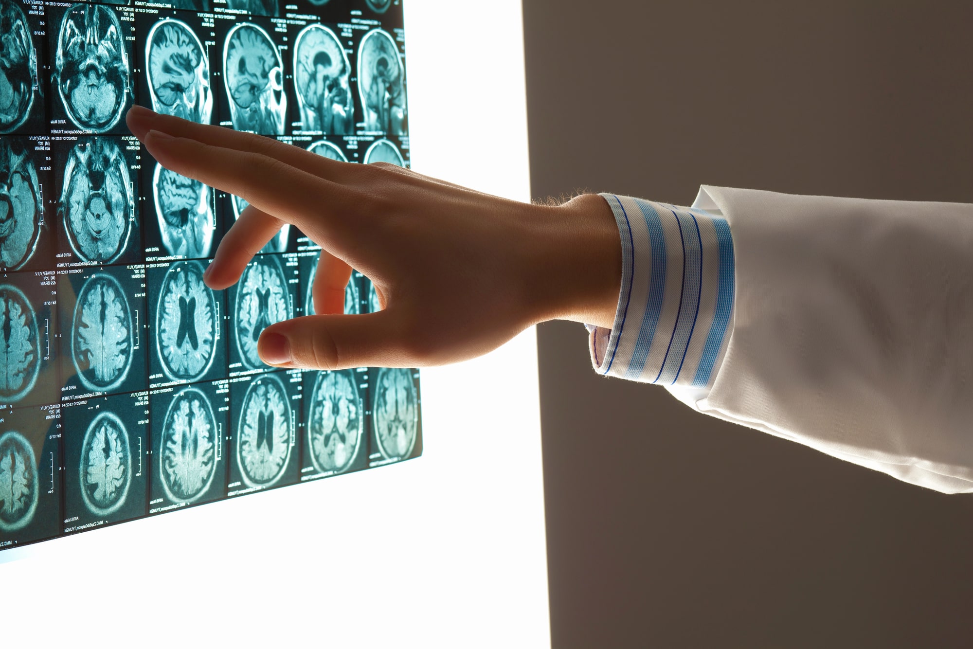Brain injury lawyer DeLand, FL